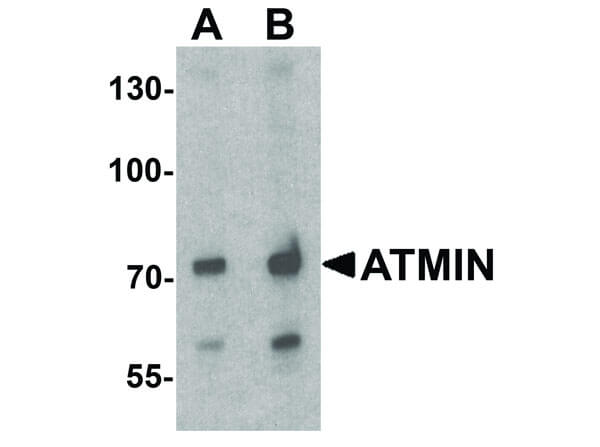 Western Blot of ATMIN Antibody