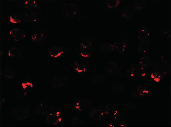 Immunofluorescence of ATMIN Antibody