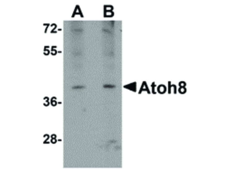 Western Blot of ATOH8 Antibody