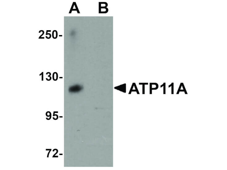 Western Blot of ATP11A Antibody