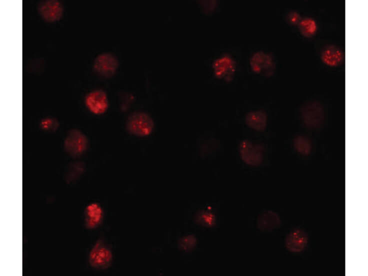 Immunofluorescence of ATP11A Antibody