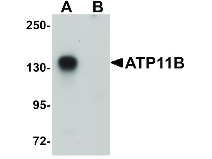 Western Blot of ATP11B Antibody