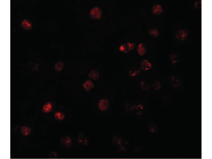 Immunofluorescence of ATP11B Antibody