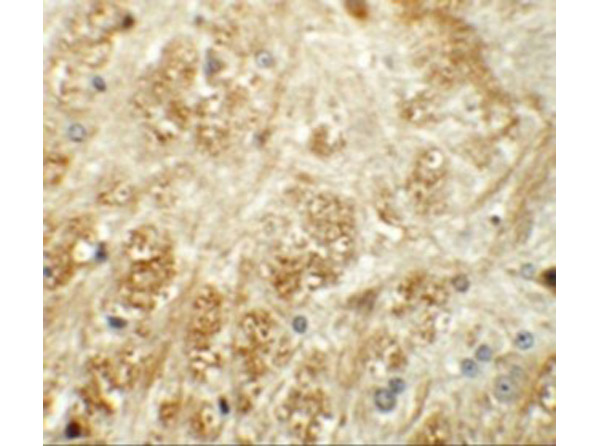 Immunohistochemistry of ATP2C1