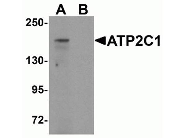 Western blot analysis of ATP2C1
