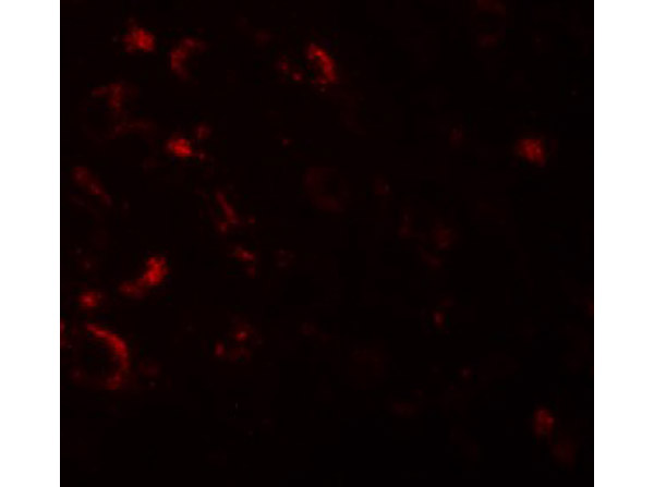 Immunofluorescence of AXIN1