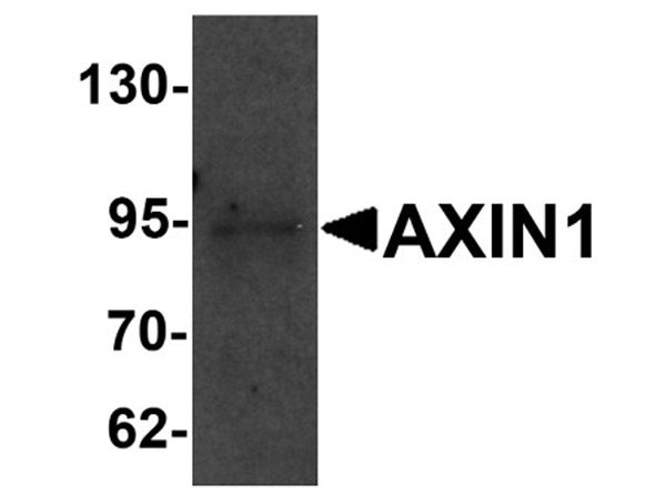 Western blot of AXIN1