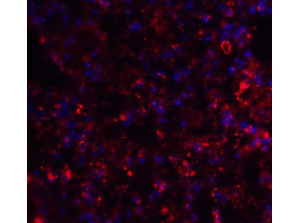 Immunofluorescence of AXIN2