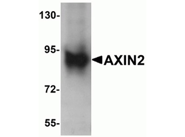 Western blot analysis of AXIN2