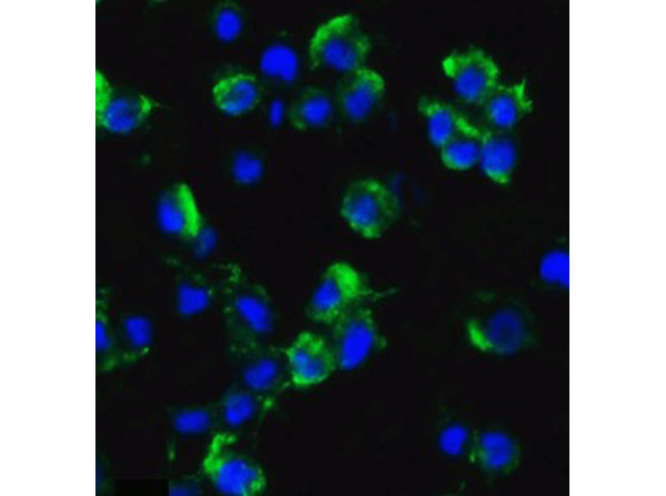 Immunofluorescence of AXIN2