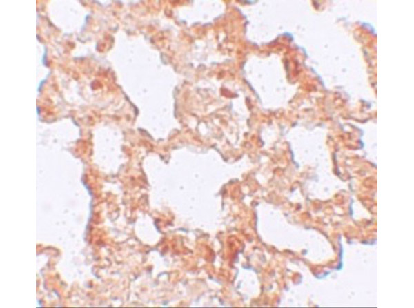 Immunohistochemistry of AXIN2