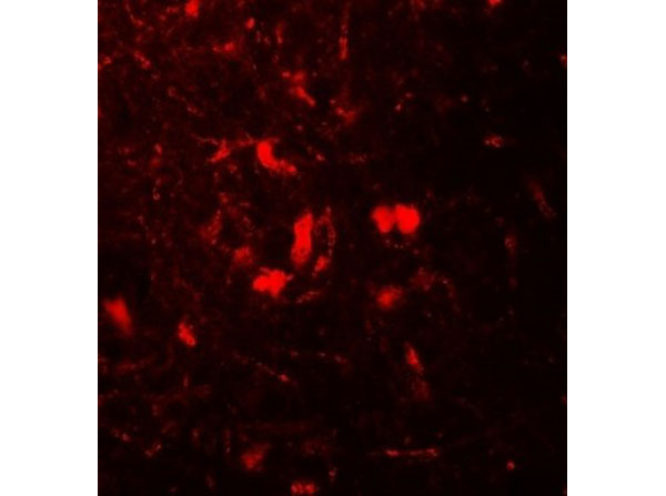 Immunofluorescence of Beta 2 Microglobulin