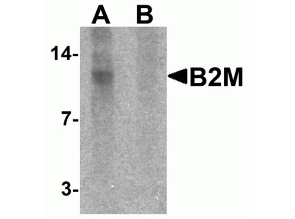 Western blot of Beta 2 Microglobulin