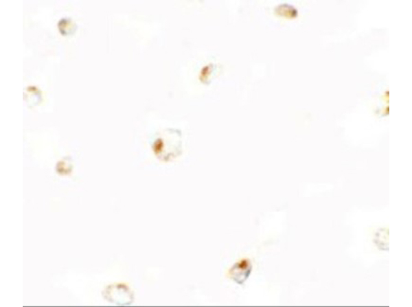 Immunocytochemistry of B9D1