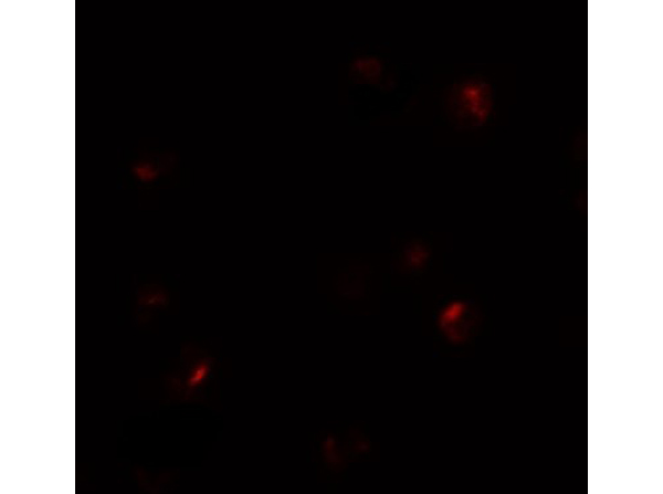 Immunofluorescence of B9D1