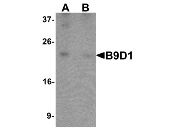 Western blot analysis of B9D1