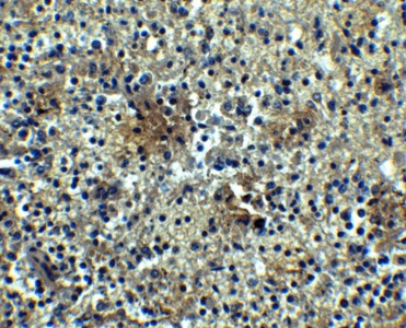 Immunohistochemistry of BAFF-R