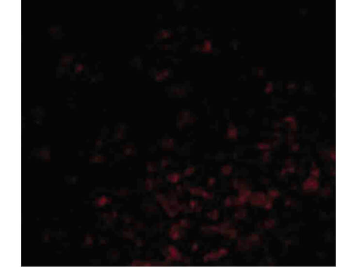Immunofluorescence of BAG-1 Antibody