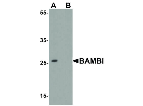 Western Blot of BAMBI Antibody