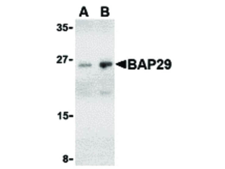 Western Blot of BAP29 Antibody