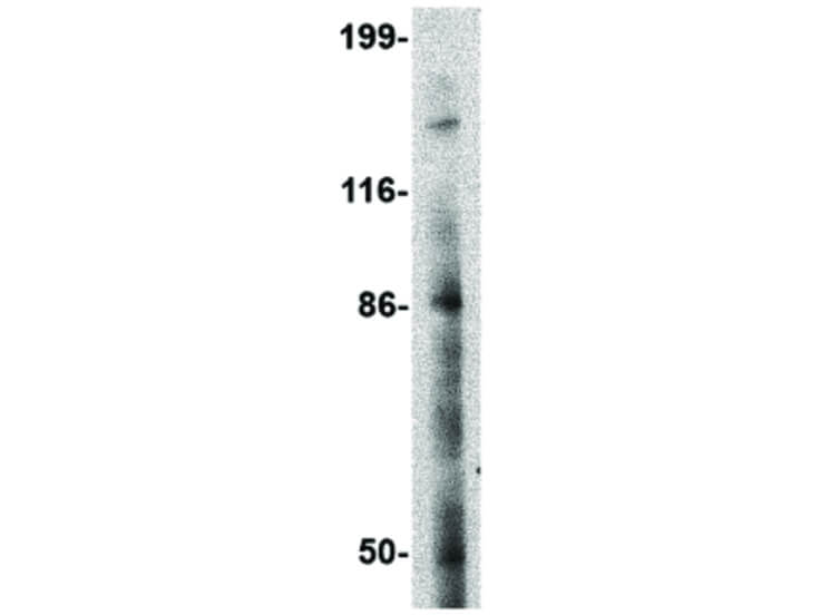 Western Blot of BAP3 Antibody