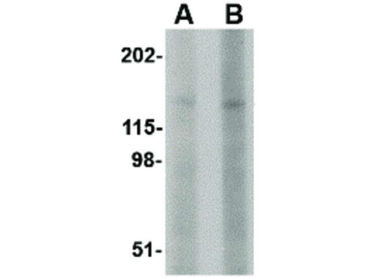 Western Blot of BAP3 Antibody
