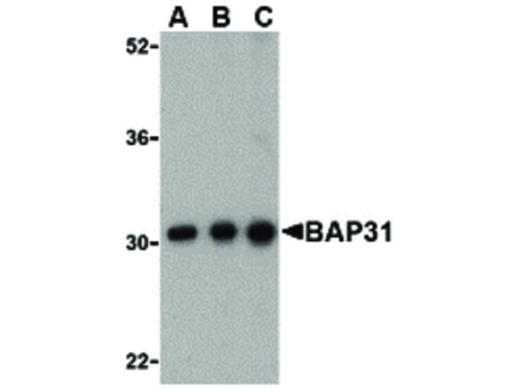 Western Blot of BAP31 Antibody