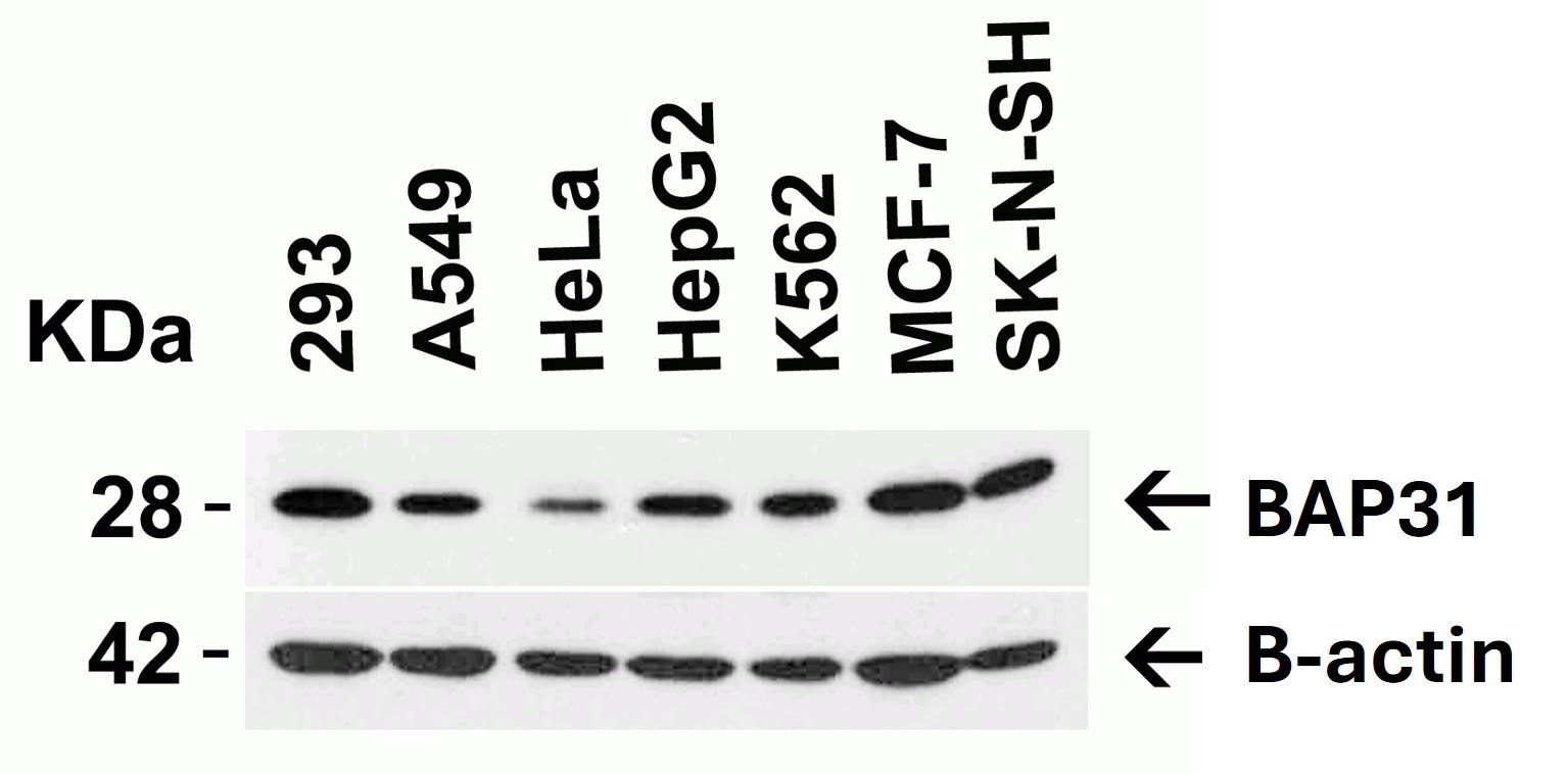 Western Blot using BAP31