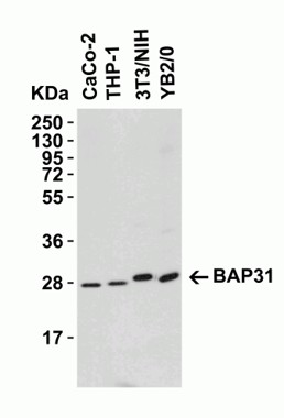 Western Blot using BAP31