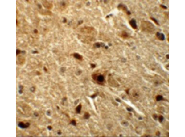 Immunohistochemistry of BAPX1