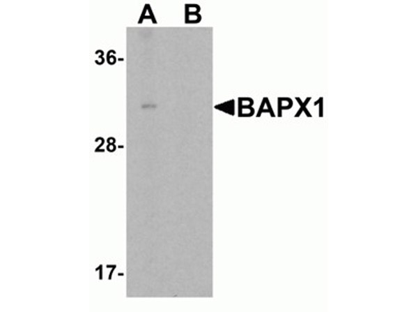 Western blot analysis of BAPX1