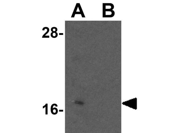 Western Blot of BATF3 Antibody