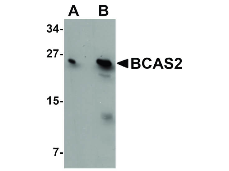 Western Blot of BCAS2 Antibody
