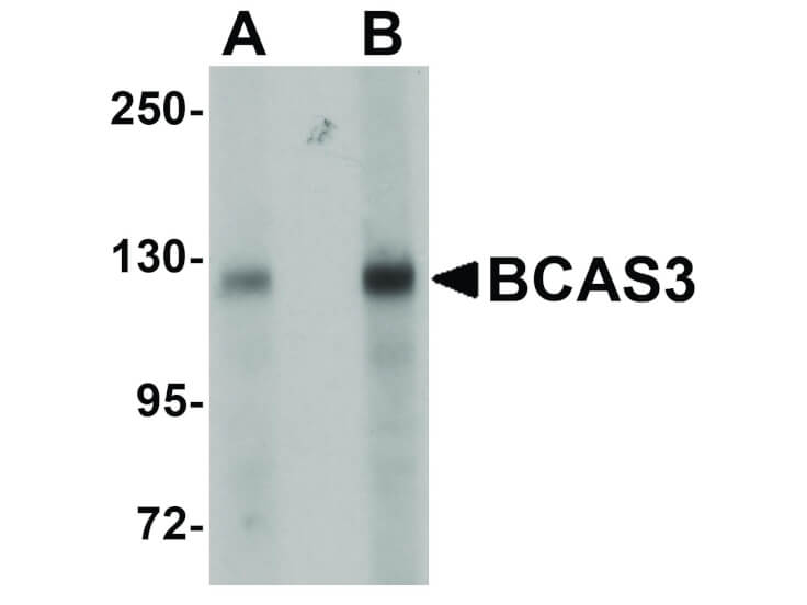 Western Blot of BCAS3 Antibody