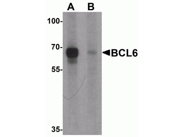 Western blot analysis of BCL6