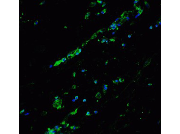 Immunofluorescence of Bcl9L