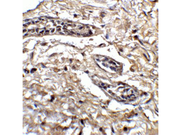 Immunohistochemistry of Bcl9L