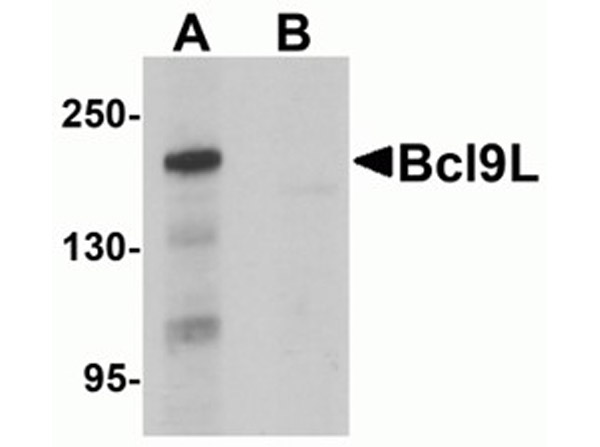 Western blot analysis of Bcl9L