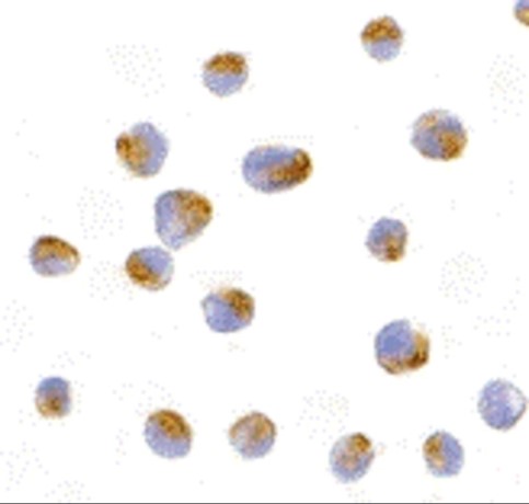 Immunocytochemistry of Bcl-B