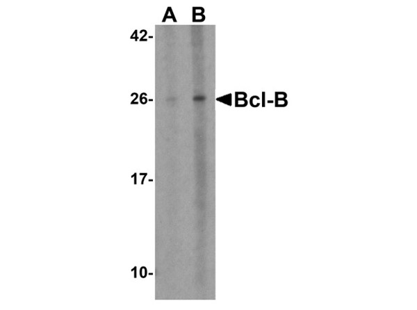 Western blot analysis of Bcl-B