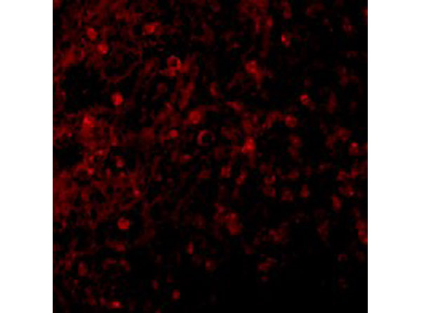 Immunofluorescence Validation of BCMA