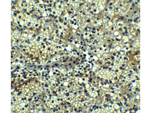 Immunohistochemistry Validation of BCMA.