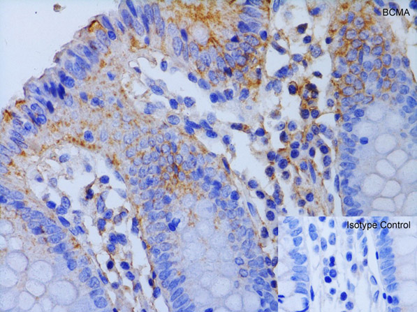 Immunohistochemistry Validation of BCMA.