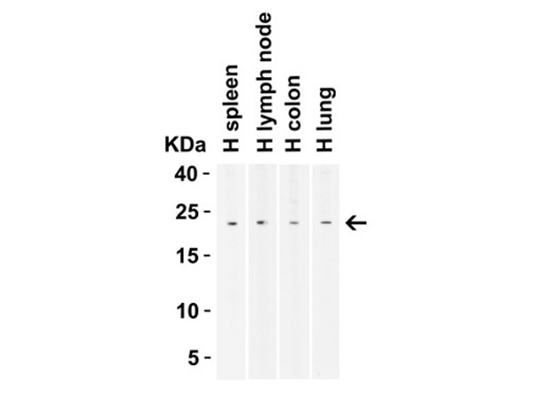 Western Blot Validation of BCMA.