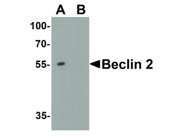 Western Blot of Beclin 2 Antibody