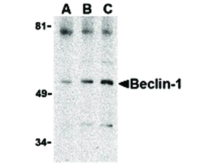 Western Blot of Beclin-1 Antibody