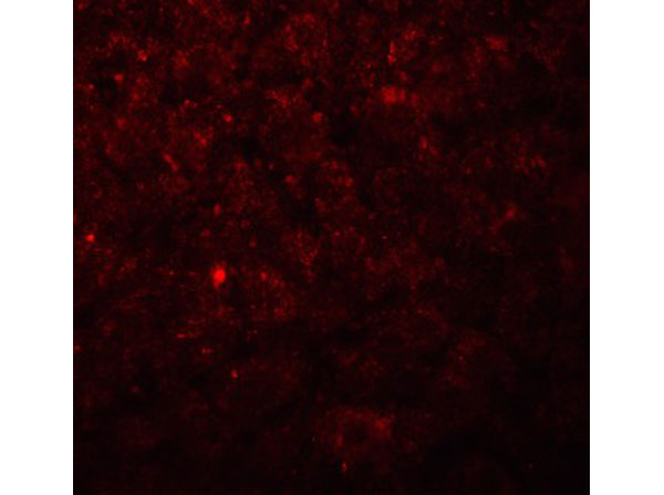 Immunofluorescence of Betatrophin