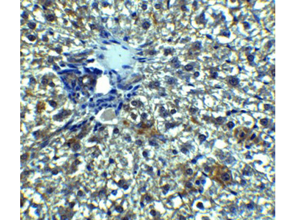 Immunohistochemistry of Betatrophin
