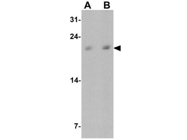 Western blot of Betatrophin