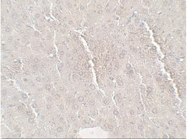 Immunohistochemistry of Betatrophin